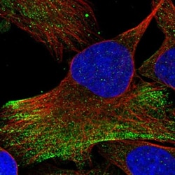 RNF25 Antibody, Novus Biologicals:Antibodies:Primary Antibodies